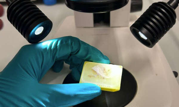 Analizzate cellule cerebrali di oltre 10 anni fa